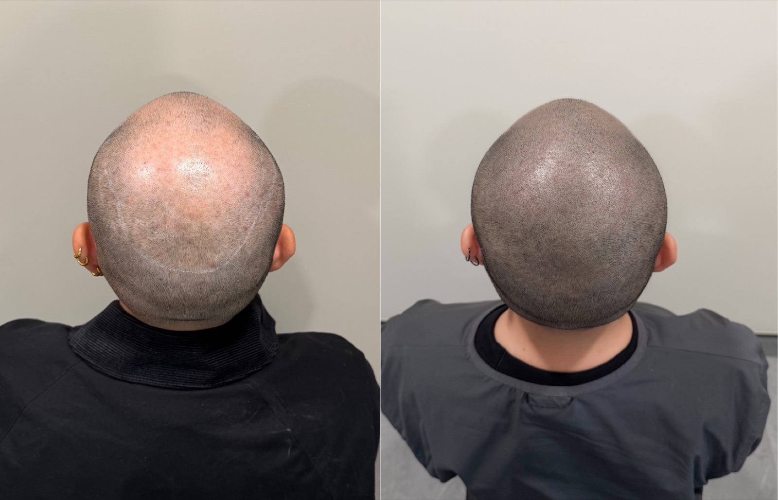 Shaved look SMP portfolio 16